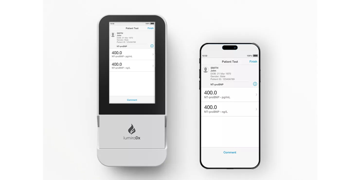 Instrumento LumiraDx conectado a un teléfono con resultados de pruebas